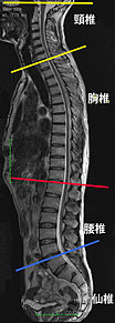 脊髄損傷 プリ画像