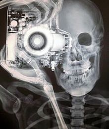 X rayの画像(レントゲンに関連した画像)