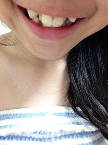 歯並びの画像(歯科矯正に関連した画像)