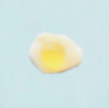 卵 グミ プリ画像