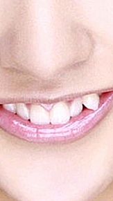 八重歯 悩みの画像(八重歯に関連した画像)